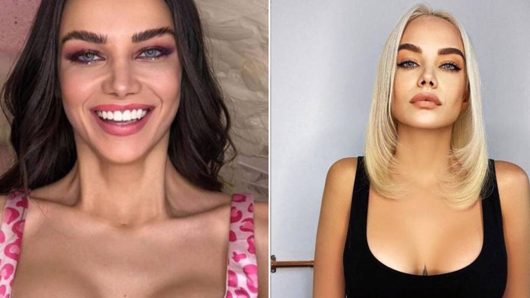 İşte Benim Stilim yarışmasıyla tanınmıştı... Ayşenur Balcı'nın son halini görenler şok oluyor! Yaptırmadığı yeri kalmamış 7